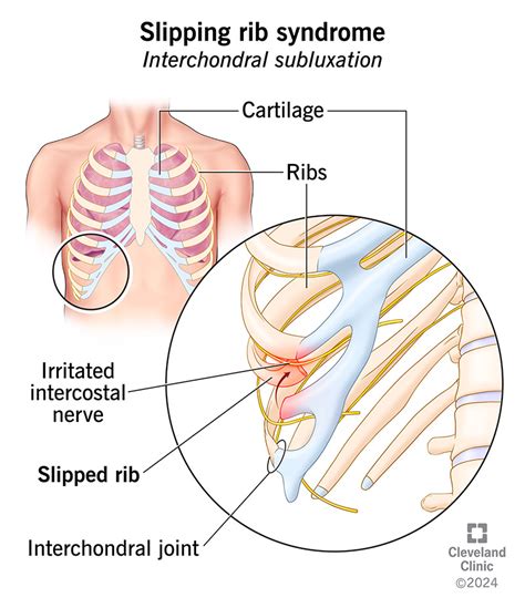 Identifying Pain Types to Pinpoint Their Origins